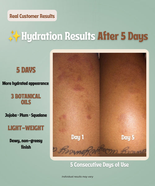 Sunshine Body Oil | Lightweight Hydration for Sensitive Skin